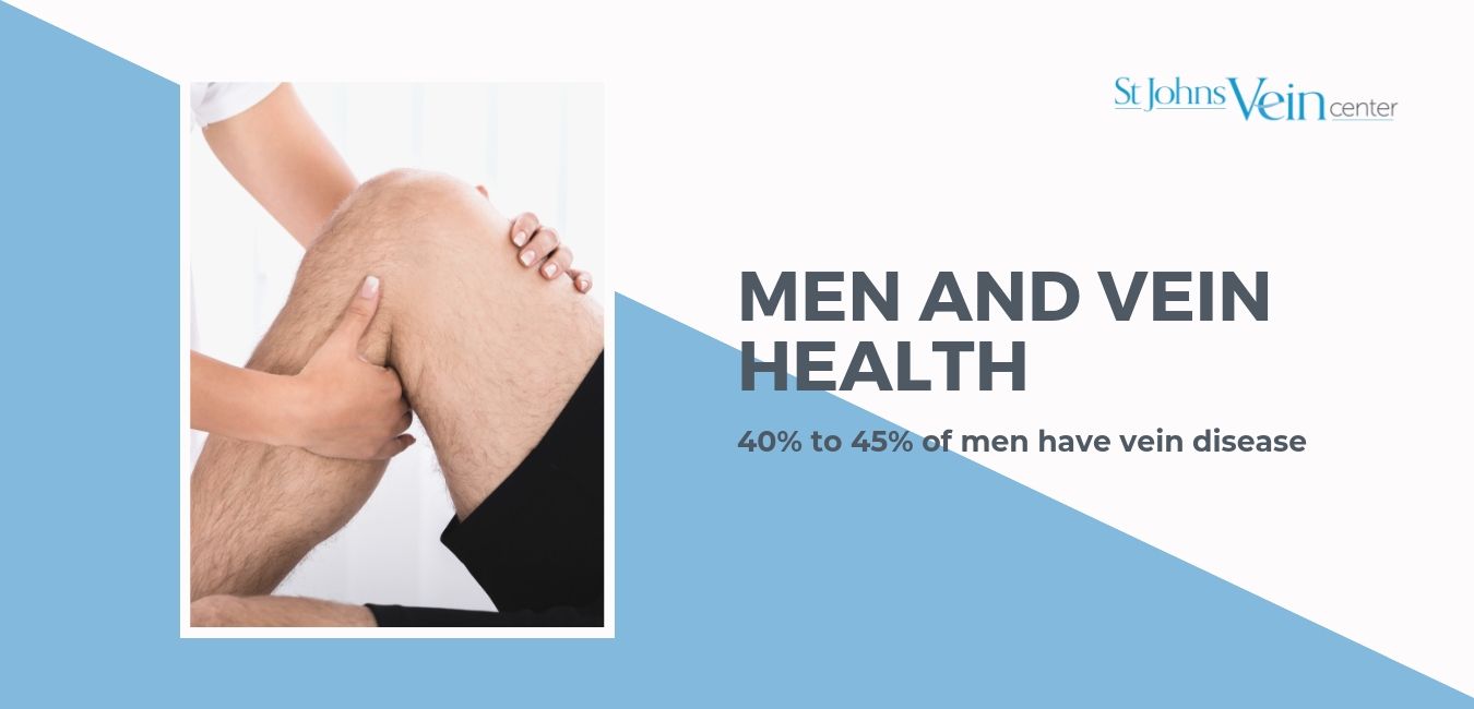 men vein health