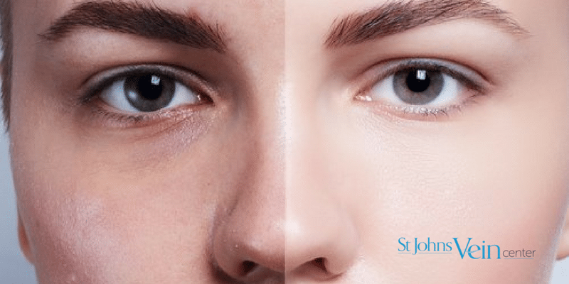 skin discoloration treatments
