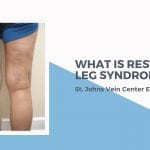 What is Restless Leg Syndrome? St. Johns Vein Center Explains