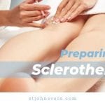 Preparing for Sclerotherapy