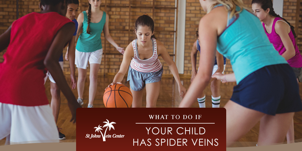 What to do if you child has spider veins