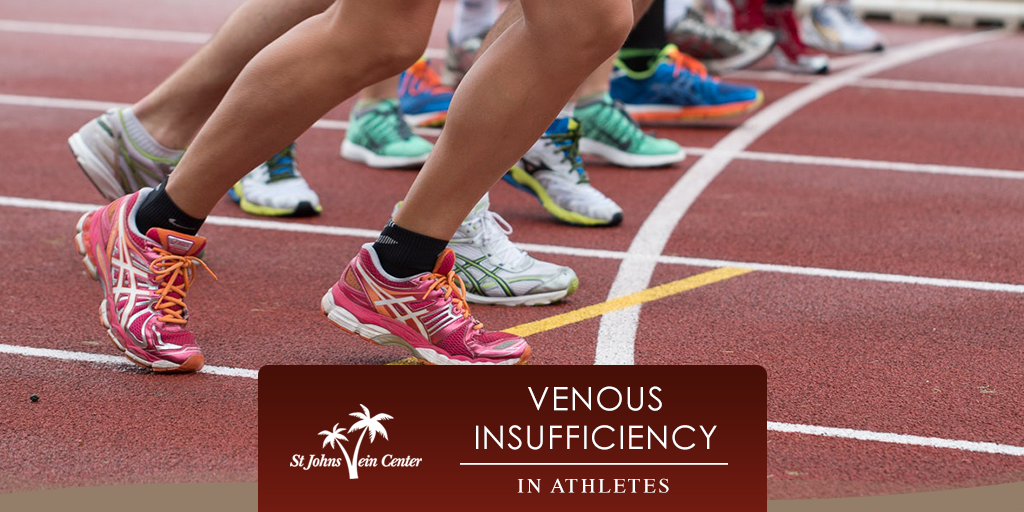 sjvc-venous-insufficiency-in-athletes