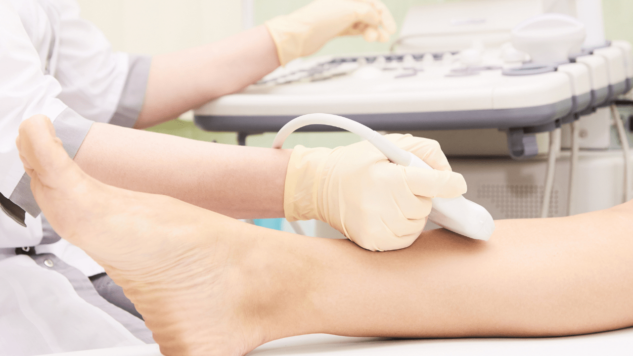 what to expect from a vein screening