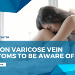 Common Varicose Vein Symptoms To Be Aware Of