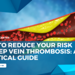 How To Reduce Your Risk Of Deep Vein Thrombosis: A Practical Guide