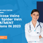 Varicose Veins And Spider Vein TREATMENT Options IN 2023