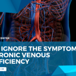 Don’t Ignore The Symptoms Of Chronic Venous Insufficiency