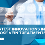 Latest Innovations in Varicose Vein Treatments