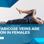 why varicose veins are common in females