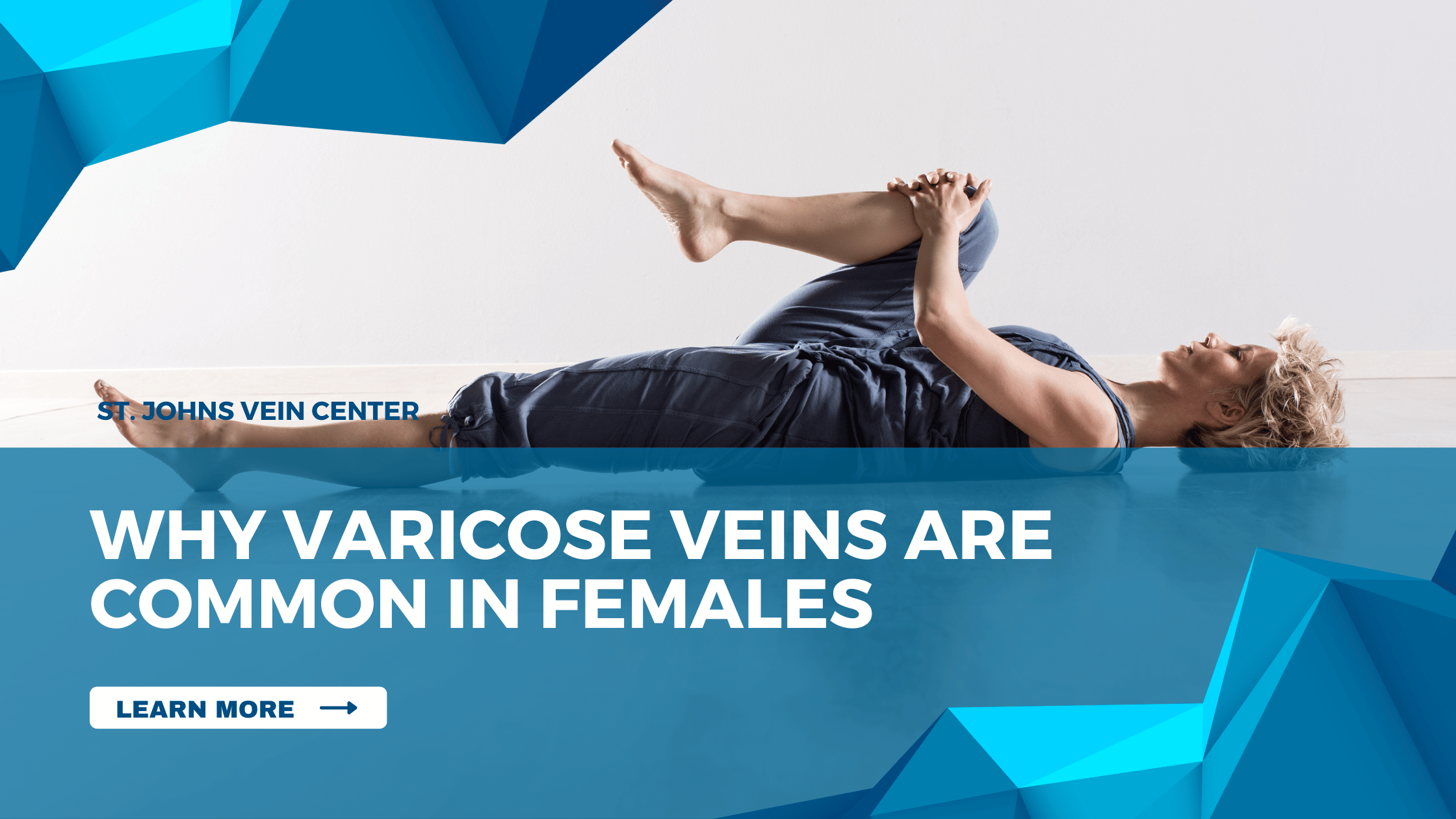 why varicose veins are common in females