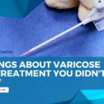10 Things About Varicose Vein Treatment You Didn’t Know