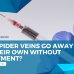 Can Spider Veins Go Away On Their Own Without Treatment?