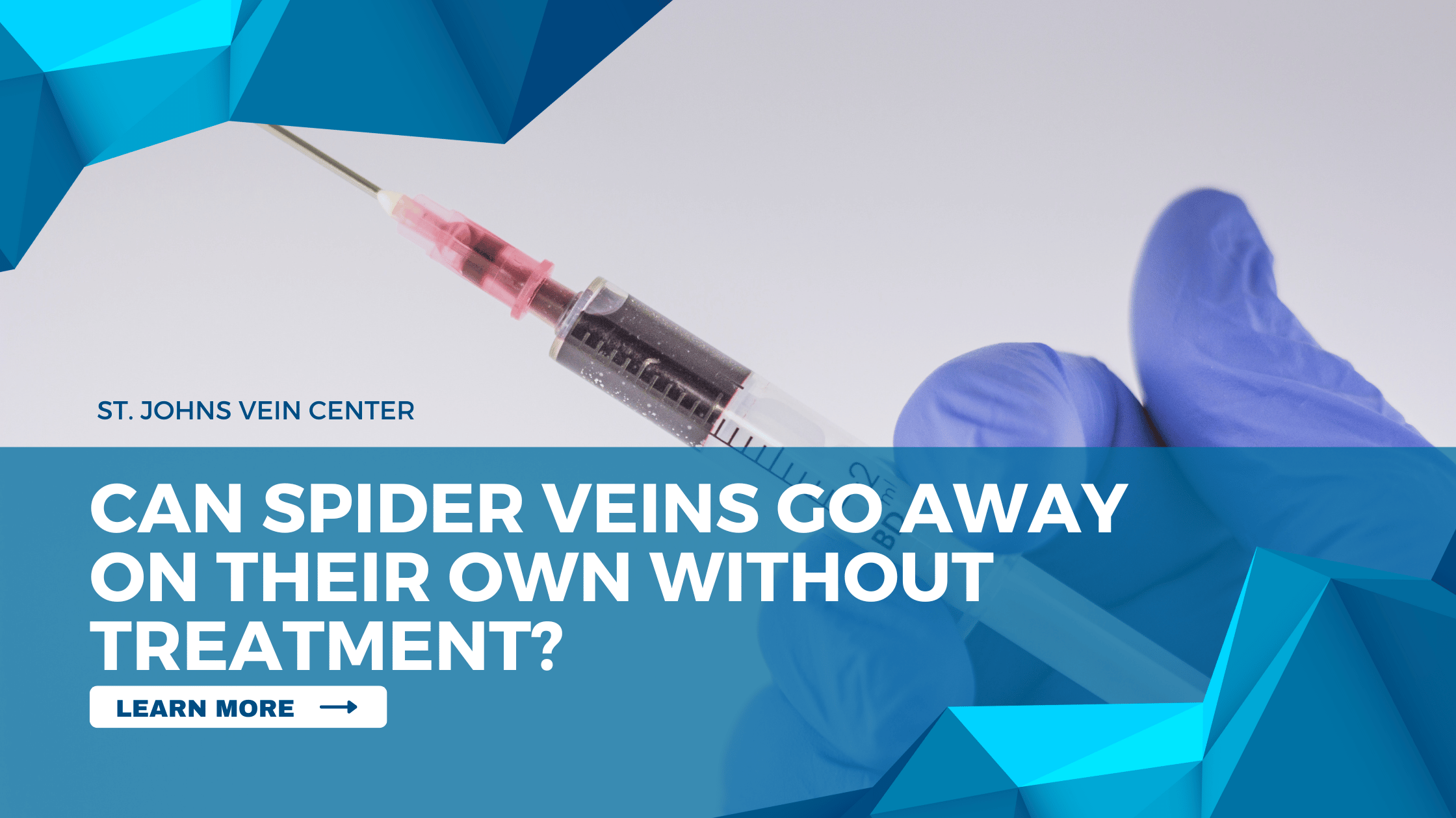Can SPIDER VEINS Go Away On Their Own Without Treatment