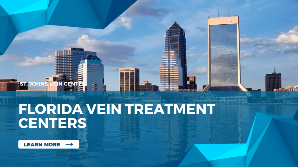 Florida vein treatment centers