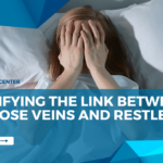 Identifying the Link Between Varicose Veins and Restless Legs