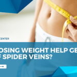 Can Losing Weight Help Get Rid of Spider Veins?