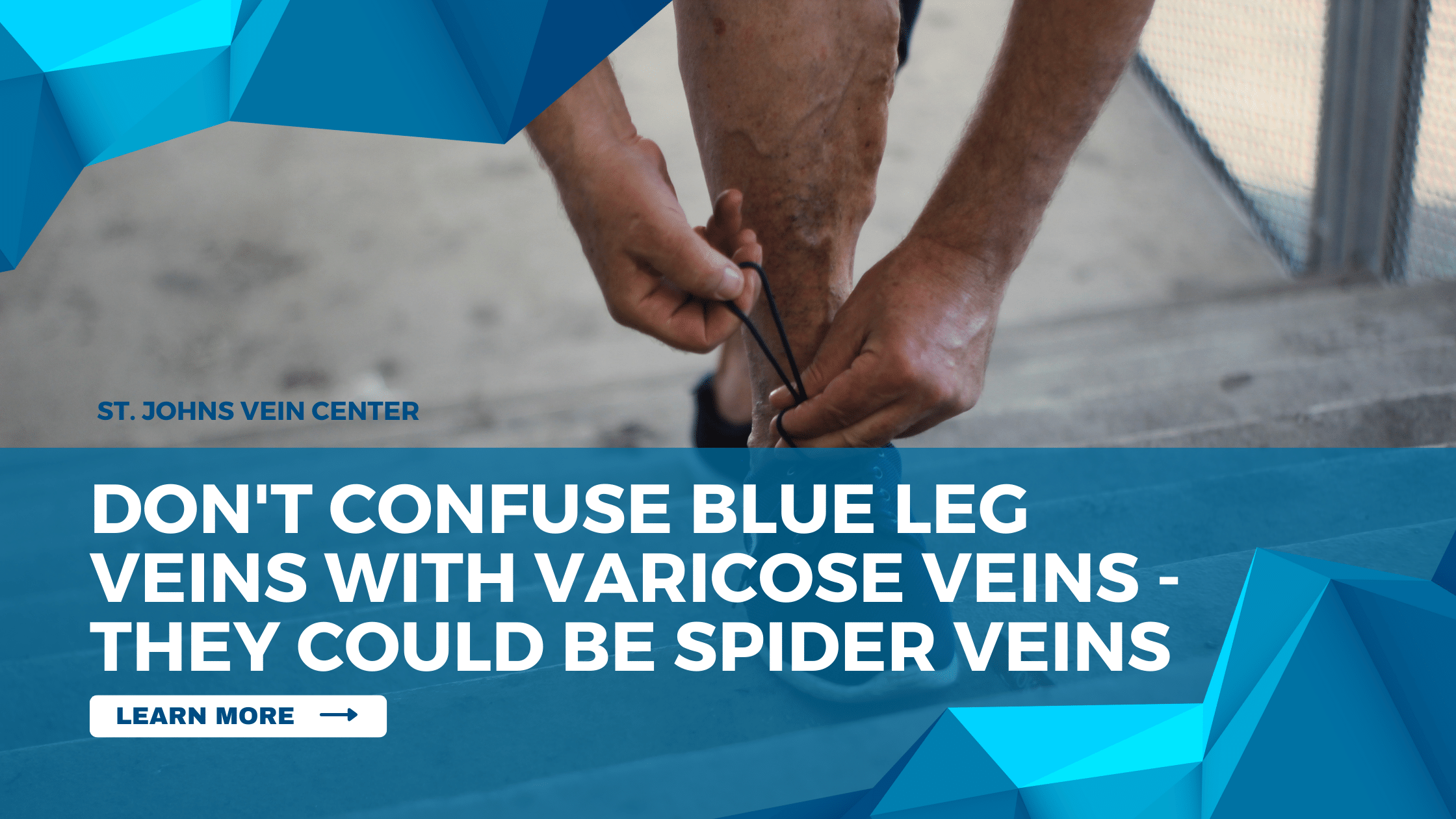 Blue Leg Veins