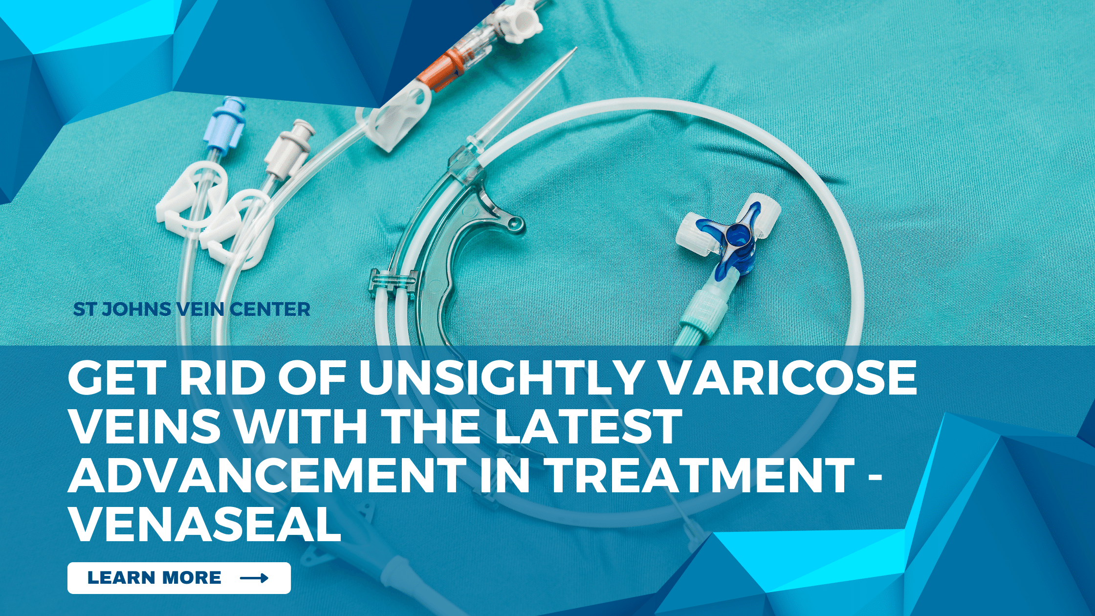 Get Rid of Unsightly Varicose Veins with the Latest Advancement in Treatment - Venaseal
