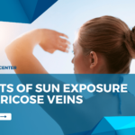 Effects of sun exposure on varicose veins