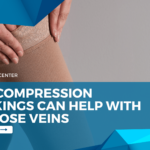 How Compression Stockings Can Help with Varicose Veins