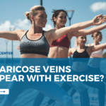 Can Varicose Veins Disappear with Exercise?