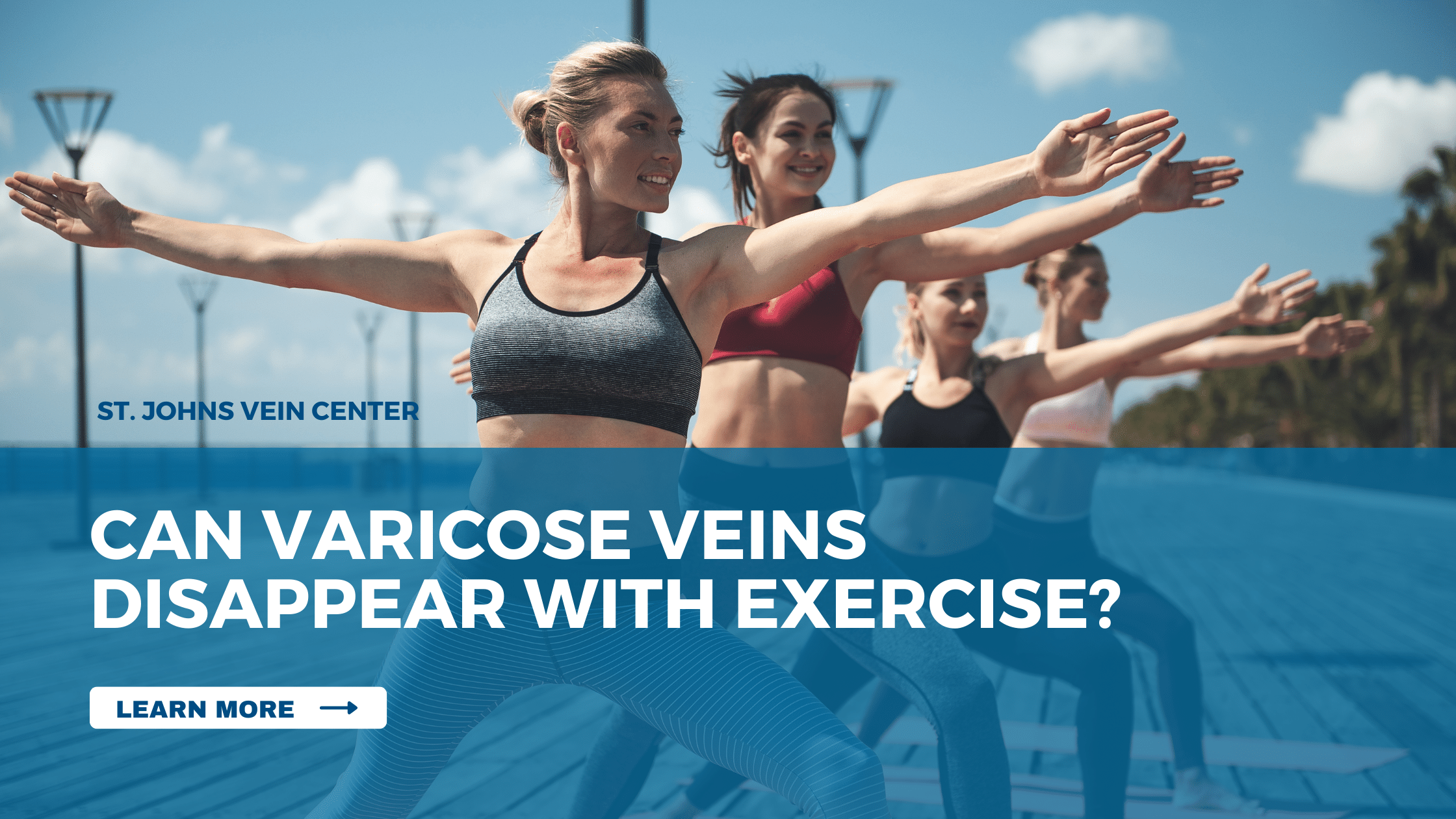 Can Varicose Veins Disappear with Exercise
