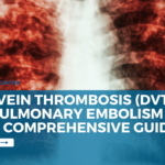 Deep Vein Thrombosis (DVT) and Pulmonary Embolism (PE): A Comprehensive Guide