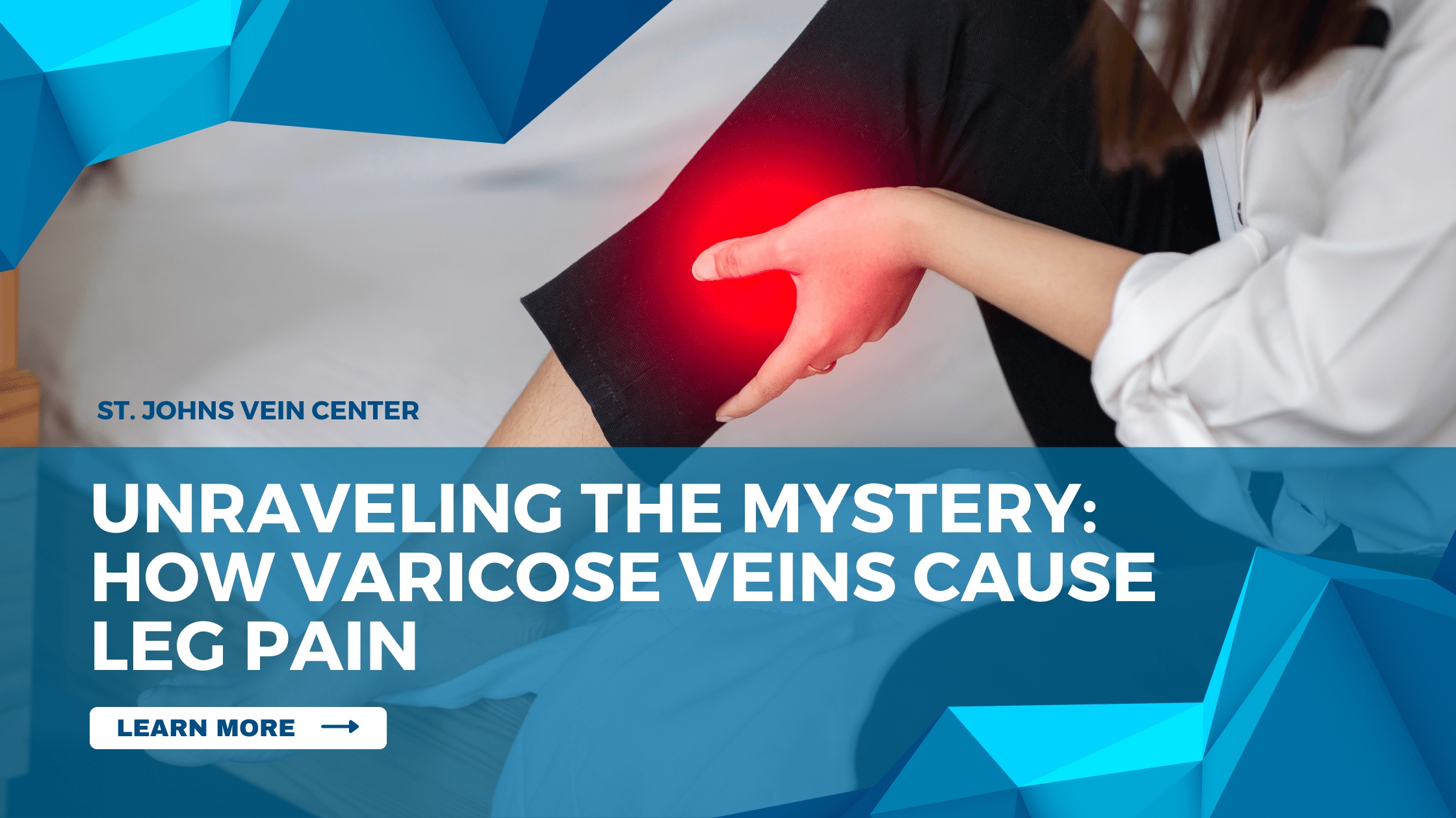 Unraveling the Mystery How Varicose Veins Cause Leg Pain