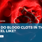 What Do Blood Clots in the Leg Feel Like?