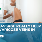 Can Massage Really Help with Varicose Veins?